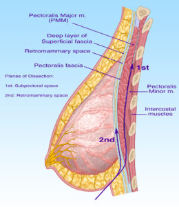  breast diagram 1