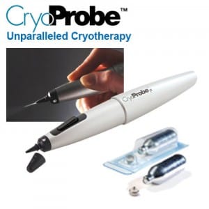 cryprobe unparalleled