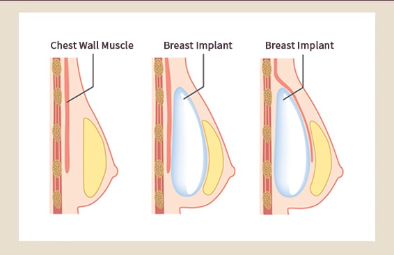 Infographic