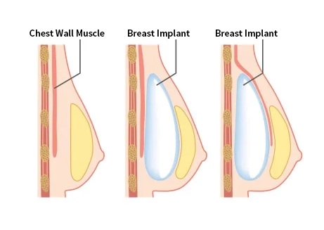 Infographic