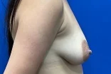 bna-sample