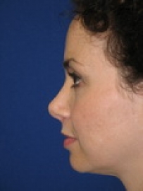 bna-sample